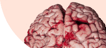 /assets_page/6d536a5c0377607b4ba4af035a01c77dce650280/brain.png