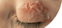 /assets_page/6d536a5c0377607b4ba4af035a01c77dce650280/eye.png