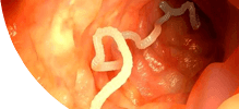 /assets_page/6d536a5c0377607b4ba4af035a01c77dce650280/intestines.png