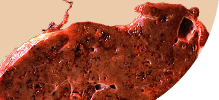 /assets_page/6d536a5c0377607b4ba4af035a01c77dce650280/liver.png